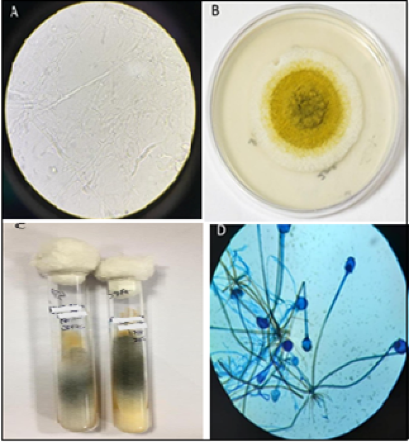 Study of Molds in Post COVID -19 Patients: An experience from Tertiary ...